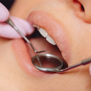 boca abierta con elementos de dentista haciendo revisión