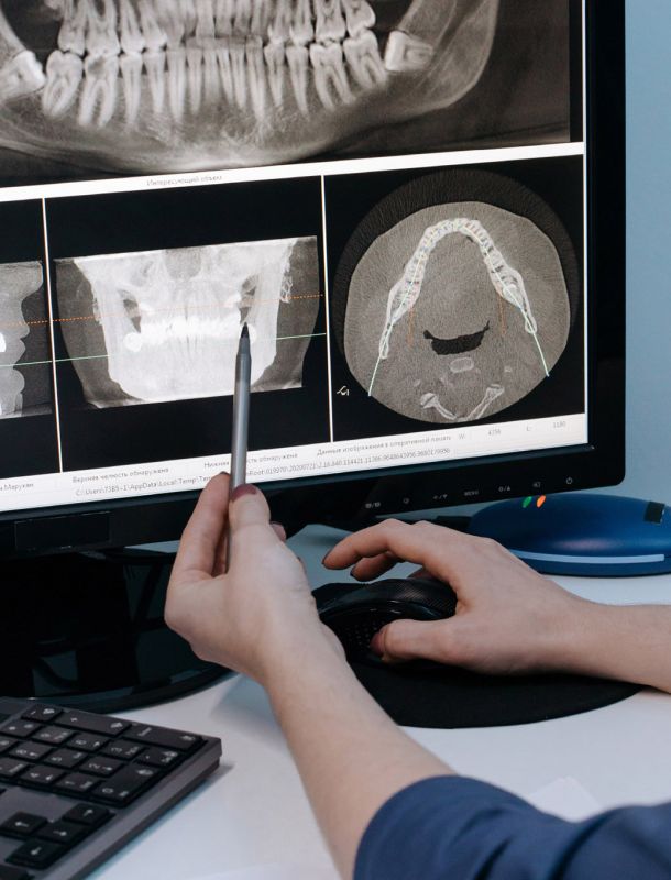 pantalla de ordenador con radiografía dientes 